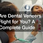 Are Dental Veneers Right for You? A Complete Guide