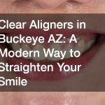 Clear Aligners in Buckeye AZ  A Modern Way to Straighten Your Smile